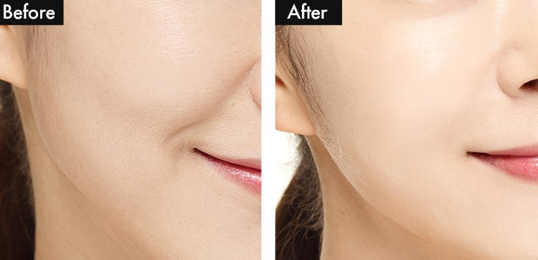 Ricocell Face Masks